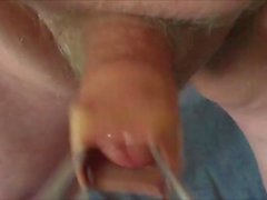 Foreskin videos